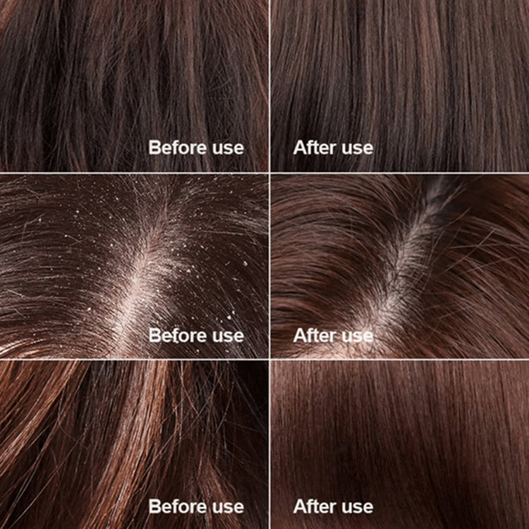 Instant Hair Regrowth Centella Scrub
