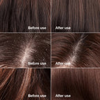 Instant Hair Regrowth Centella Scrub